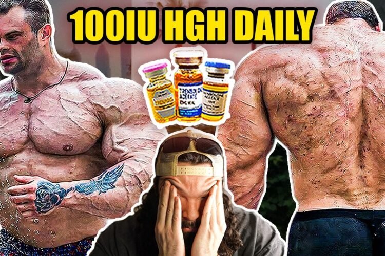 Andrey Smaev’s New Victim Sergey Danilov | 100IU HGH DAILY